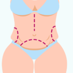 Cirurgia para o Abdômen
