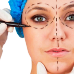 rosto de mulher sendo marcado com uma caneta por duas mãos com luvas cirúrgicas.