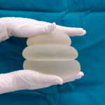 Duas mãos com luvas cirúrgicas segurando três próteses diferentes de silicone.
