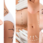 5 fotos sobre diferentes partes do corpo sinalizadas para cirurgia.