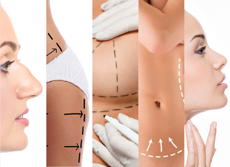 5 fotos sobre diferentes partes do corpo sinalizadas para cirurgia.