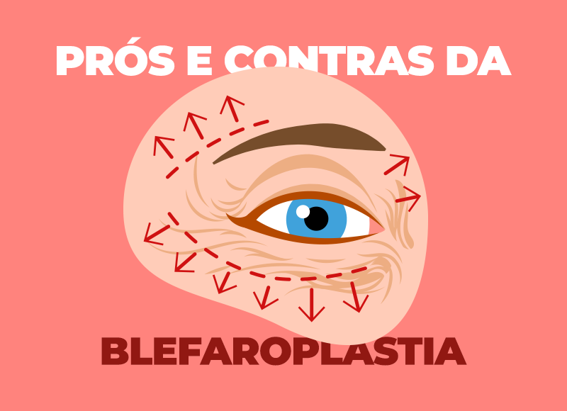 blefaroplastia