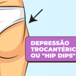 hip dips